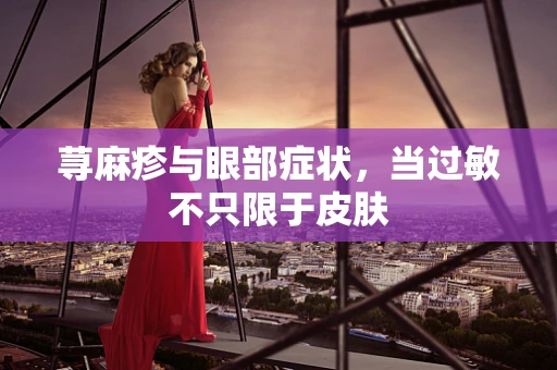 荨麻疹与眼部症状，当过敏不只限于皮肤