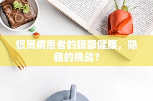 银屑病患者的眼部健康，隐藏的挑战？