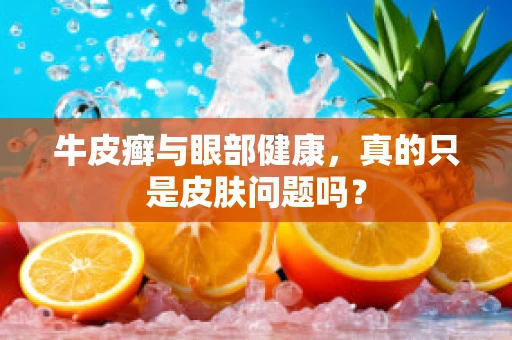 牛皮癣与眼部健康，真的只是皮肤问题吗？
